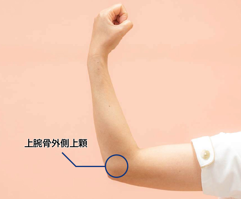 上腕骨外側上顆