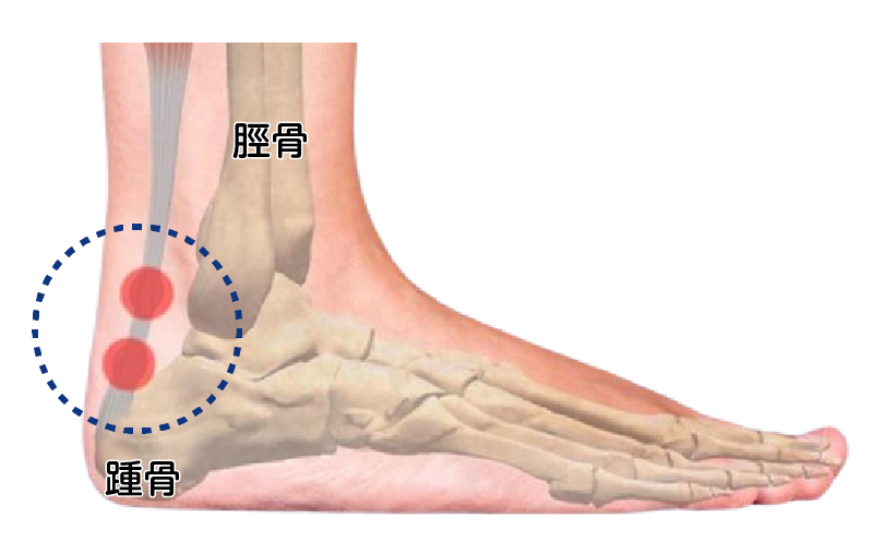 つま先立ち・動き出し時に痛くなる場所