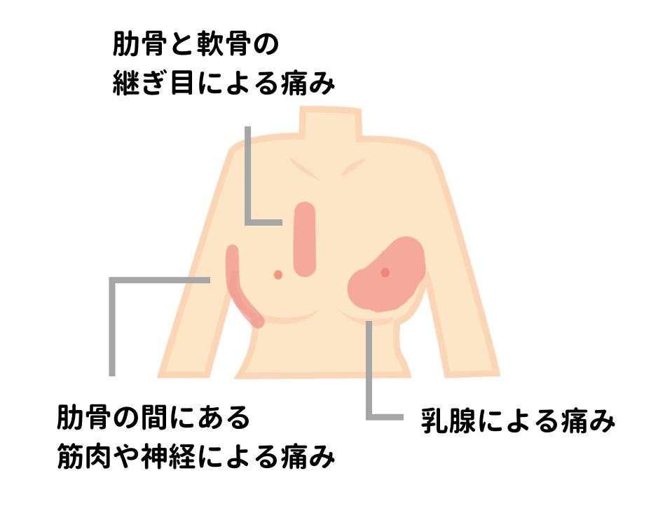 乳房の痛みの種類