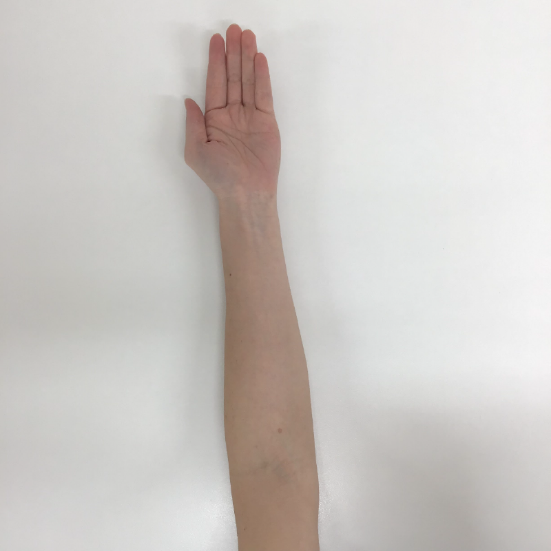 痛みのある肘をテーブルの上に乗せて、手のひらを上に向けます。