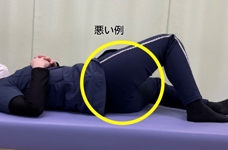 外旋方向のストレッチ　悪い例