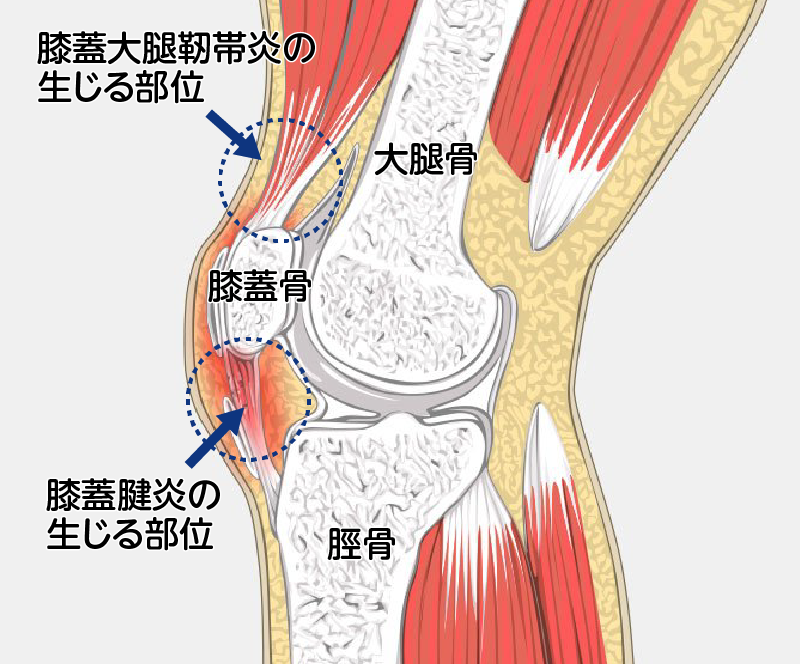 側方から見た図