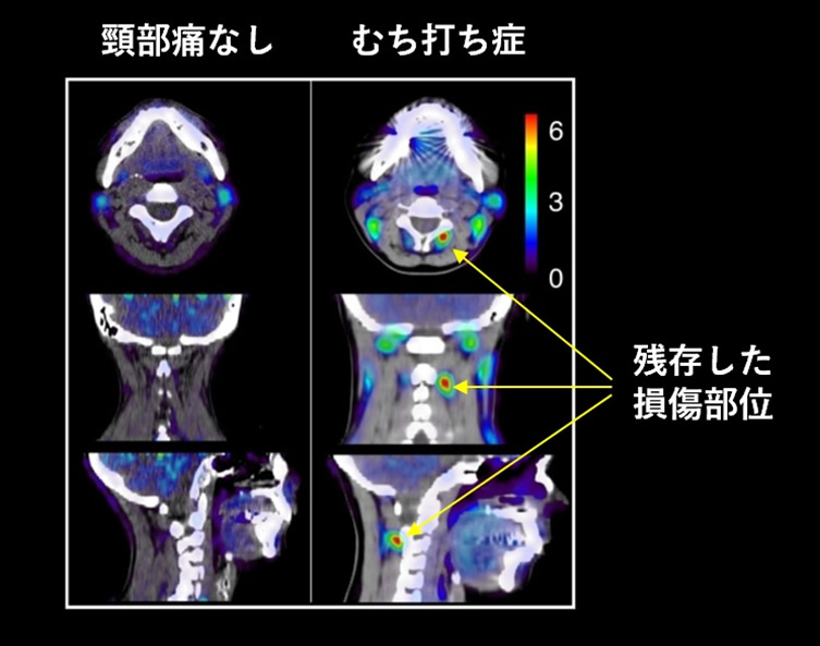 ＰＥＴという特殊な検査