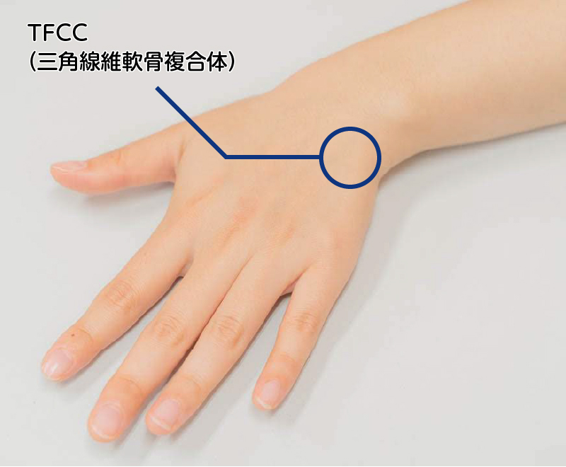 TFCC（三角線維軟骨複合体）