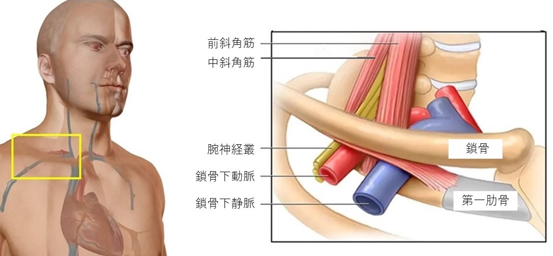 胸郭出口症候群